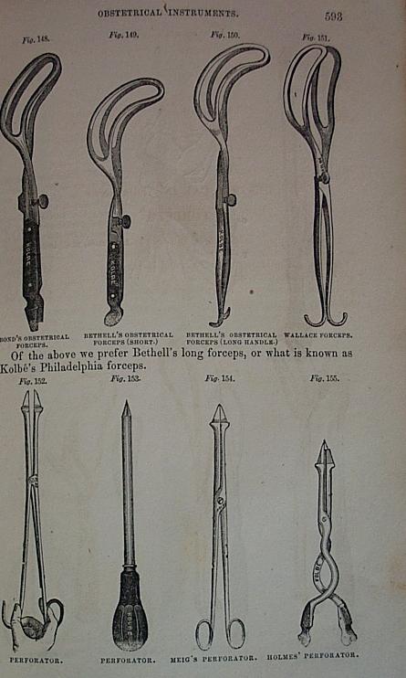 antique gynecology instruments